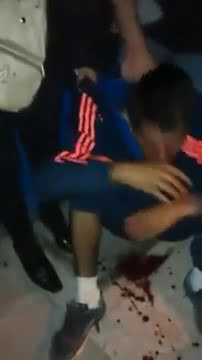 flaite lloron desangrando (2015) (subtitulado beta 1) thumbnail