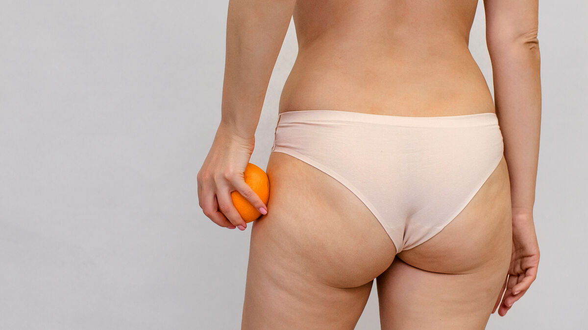 celulitis