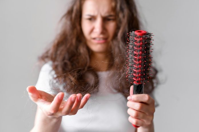 alopecia